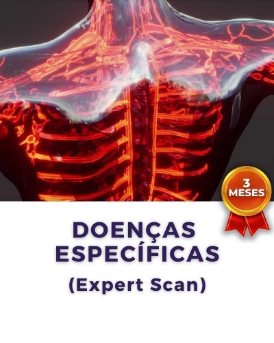 Detalhes do produto Terapia de BioAnálise: Doenças Específicas (Expert Scan)